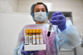 Исследователи оценили скорость исчезновения иммунитета после коронавируса