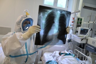 Врач-пульмонолог назвал первые симптомы поражения легких