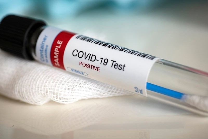 Более 591 тысячи новых случаев COVID-19 зафиксировали за сутки в мире