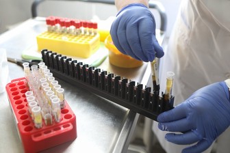 Число умерших от коронавируса в мире превысило 2,5 миллиона