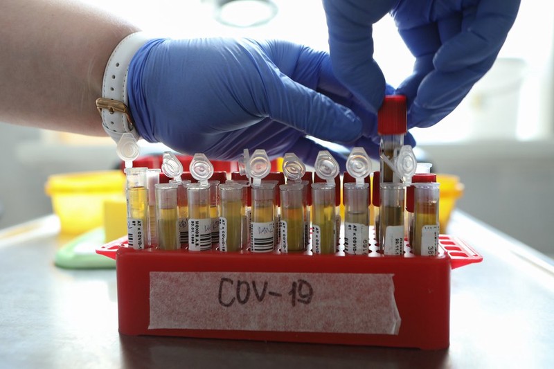 Свыше 42 миллионов тестов на коронавирус провели в России