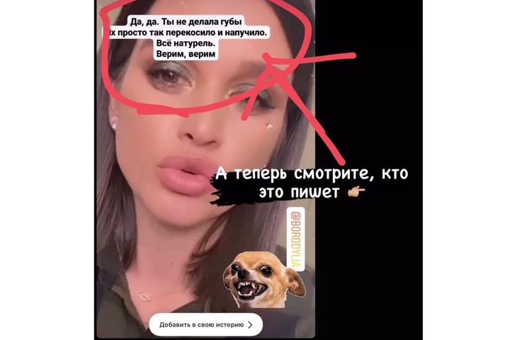 Хирург заметил следы пластики на лице Ксении Бородиной