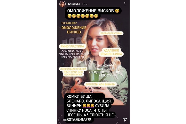 «Что ты несешь?»: Бородина резко ответила на обвинения в пластике лица