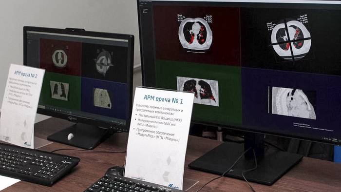 Инновационное программное обеспечение для диагностики легких начали испытывать в Москве