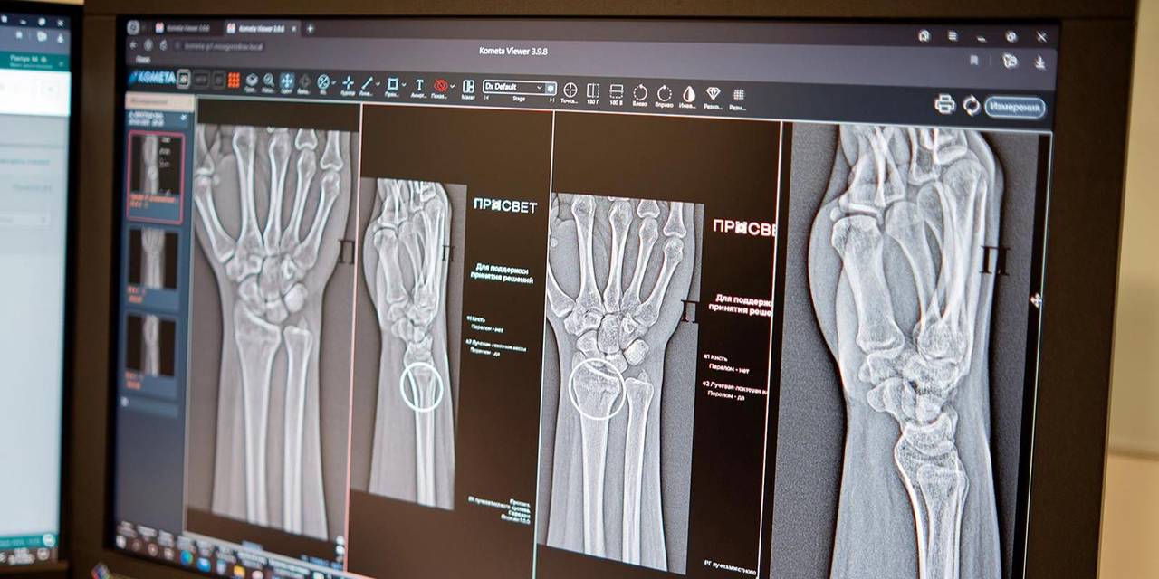 Столичным врачам стали доступны два новых ИИ-сервиса для диагностики травм суставов. Фото: сайт мэра Москвы 
